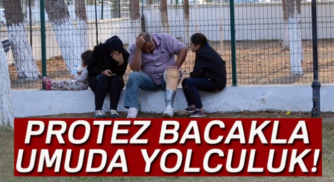 Protez bacakla umuda yolculuk